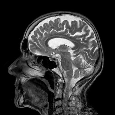 medical image of human brain interior